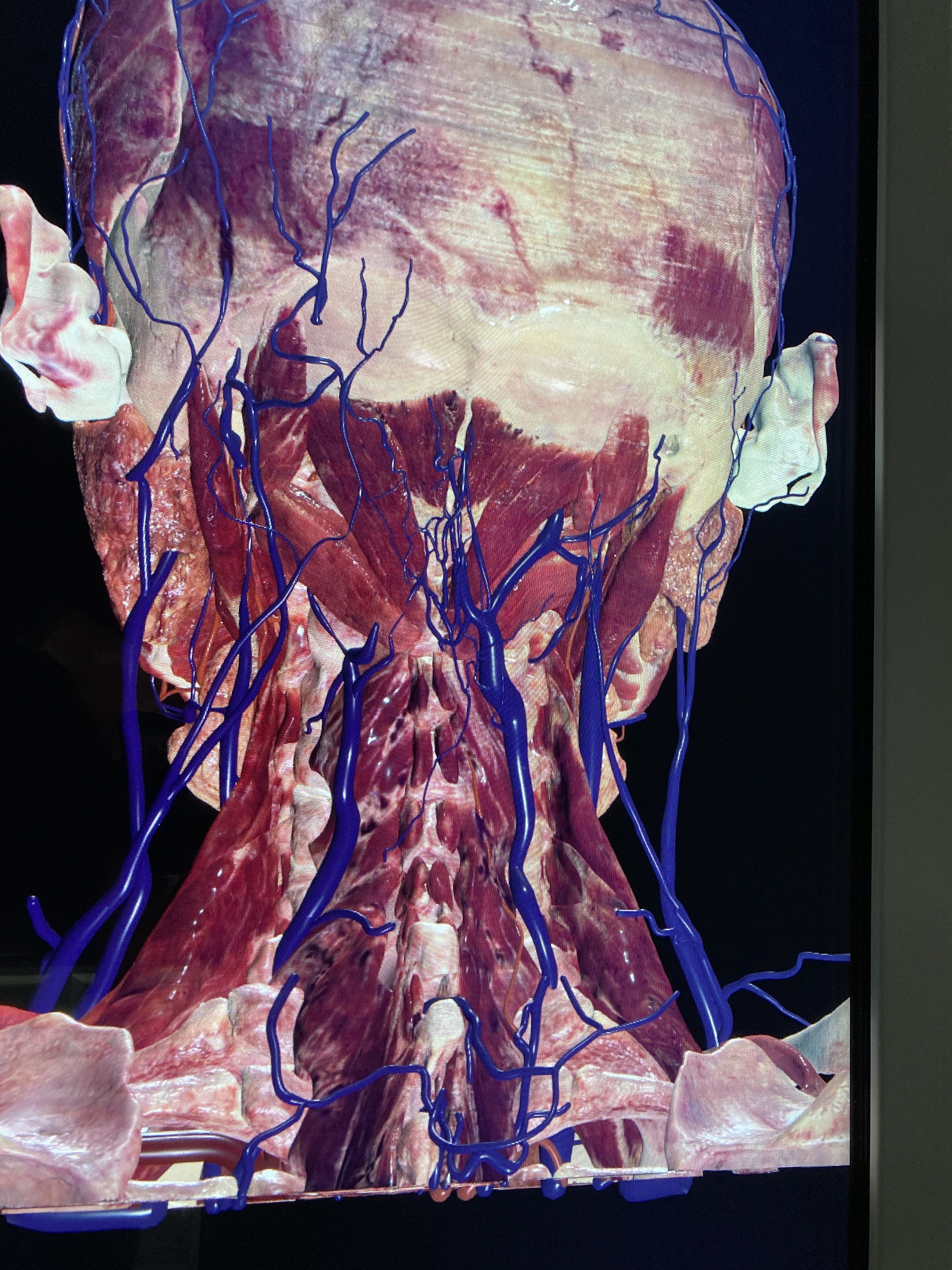 Virtuele dissectie van de cwk: Van A(natomie) naar B(etere zorg)
